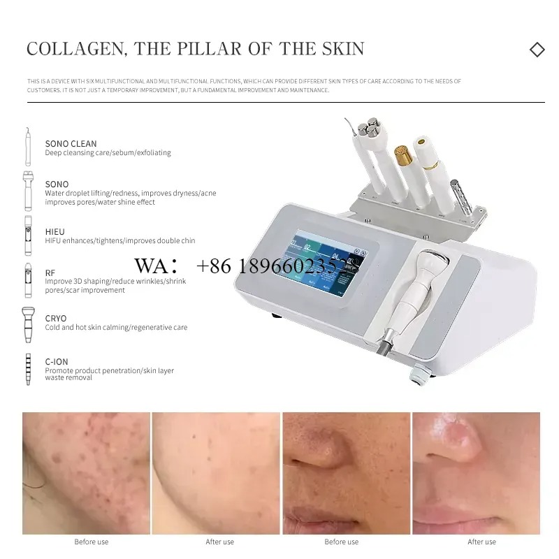 WMWMNU for Desktop Facial Lift - Home Improvement In Usa 评论和价格